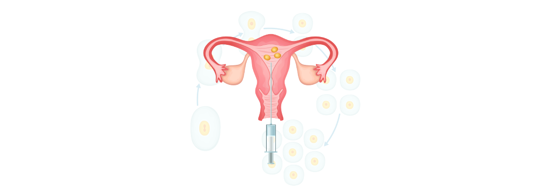 ovulation-induction